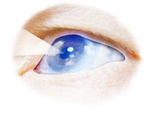 Vision